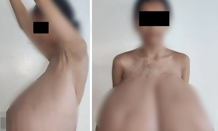 13 yaşında resmen start aldı! Göğüsleri vücut ağırlığının dörtte birine ulaştı - Haberleri: Gelişmeler Takip E