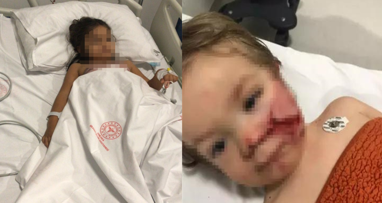 2 kardeşe felaketi yaşatan pitbullun sahibi tahliye edildi! - En Son Haber ve Merak Edilenler