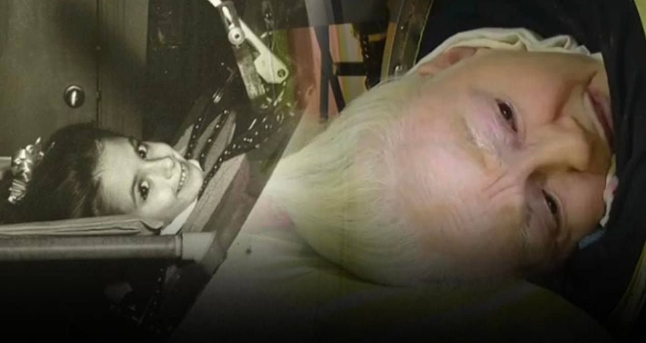 He lived with 'Iron Lung' for 68 years, he devastated death! Malfunction cost his life - Breaking News