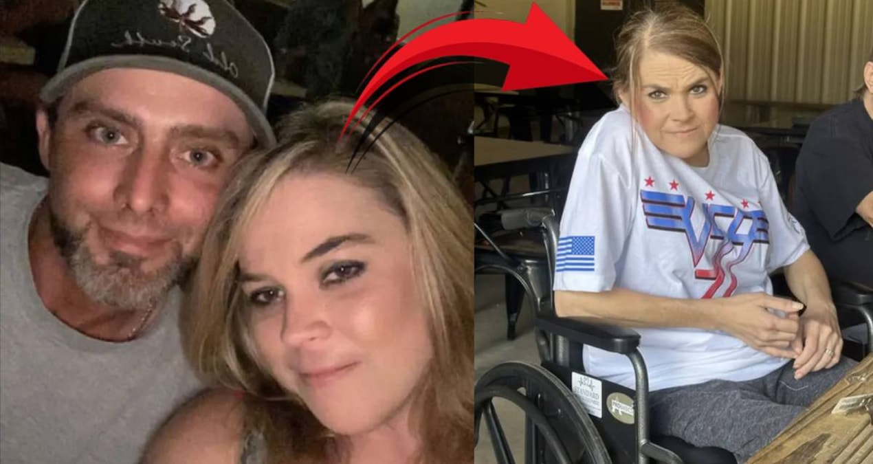 Agenda - The luxury food he ate ruined his life: They removed half of his hip with surgery: Here are the Details