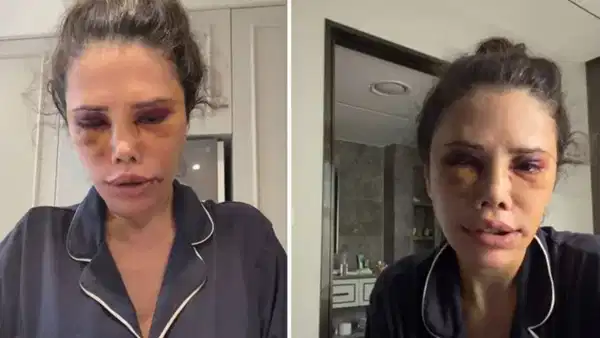 Agenda - Former Survivor contestant Didem Ceran talked about her plastic surgery in South Korea: 'The blood remains under the skin' and Latest Developments