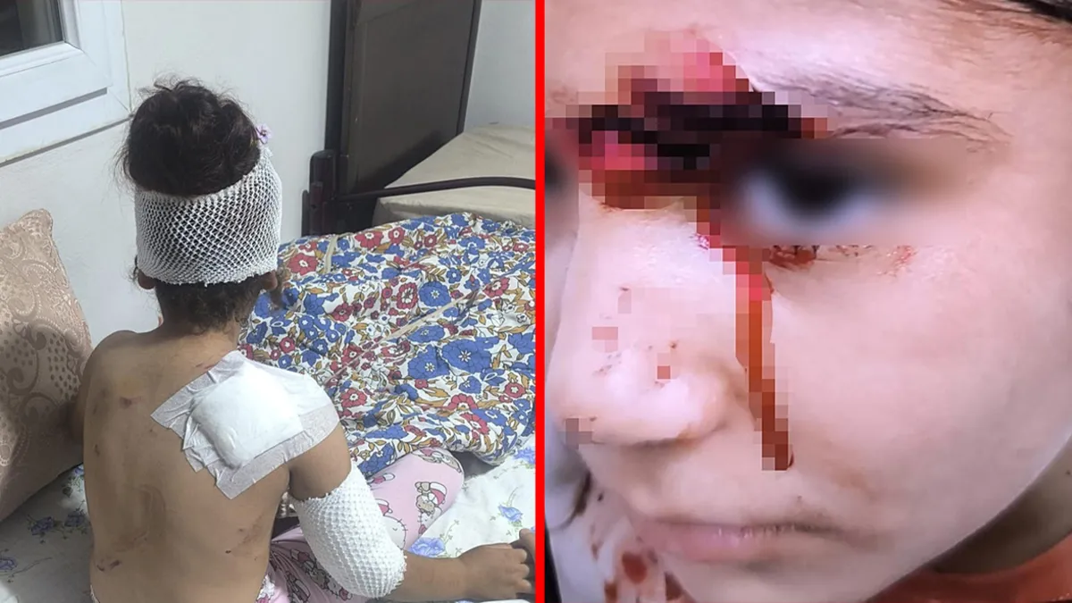 Sıcak Gündem: Analiz | Şanlıurfa'da başıboş köpek dehşeti! 8 yaşındaki çocuğa saldırdılar: 150 dikiş atıldı! |