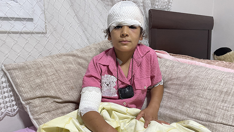 Kritik Açıklama: Son Gelişme: Şanlıurfa'da başıboş köpek saldırısı! 8 yaşındaki Evin kanlar içinde kaldı (Deta