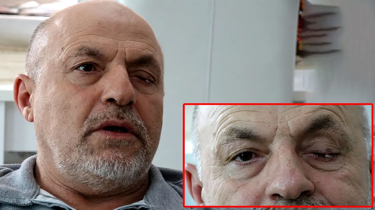 Ayrıntılar Netleşti: Trabzon’da akılalmaz olay! Gözlükten kurtulmak için gittiği hastanede gözünden oldu: Meğe