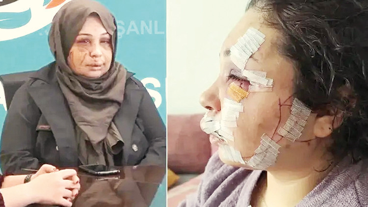 Kritik Açıklama: Analiz | Eşe işkenceye ödül gibi ceza (Detaylar) | İşte Tüm Ayrıntılar