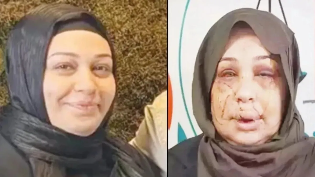 Sıcak Gündem: Boşanma aşamasındaki eşini öldüresiye darbetmişti! Polis memuruna hapis ve tahliye (Detaylar): G