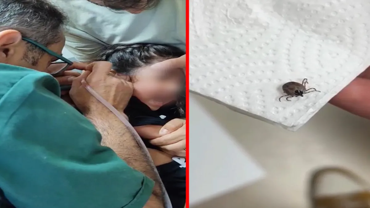 Kulak ağrısı şikayetiyle gitti: 5 yaşındaki çocuğun kulağından çıkan şoke etti! ve Merak Edilenler