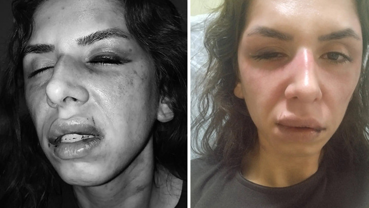 Eşini darbeden koca hakkında tutuklama kararı verildi