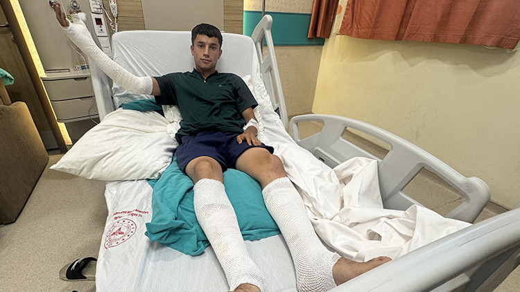 Balata spreyiyle temizlik yapıp çakmağı çakınca alevler içinde kaldı: 18 yaşındaki genç ağır yaralandı: Gelişm
