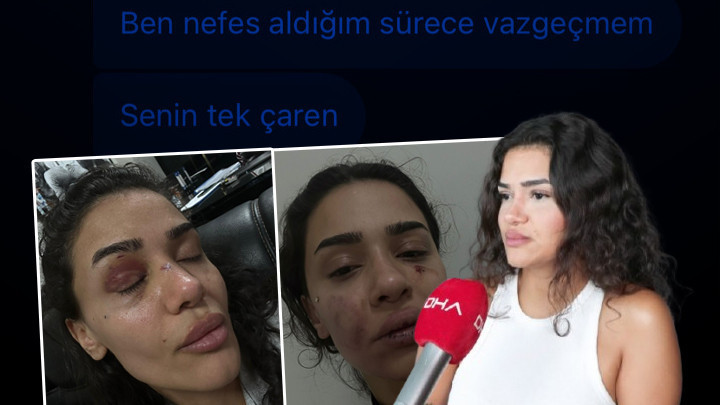 Sıcak Gündem: Hemşire Ebru'nun yardım çığlığı: Ölmeden önce sesimi duyun