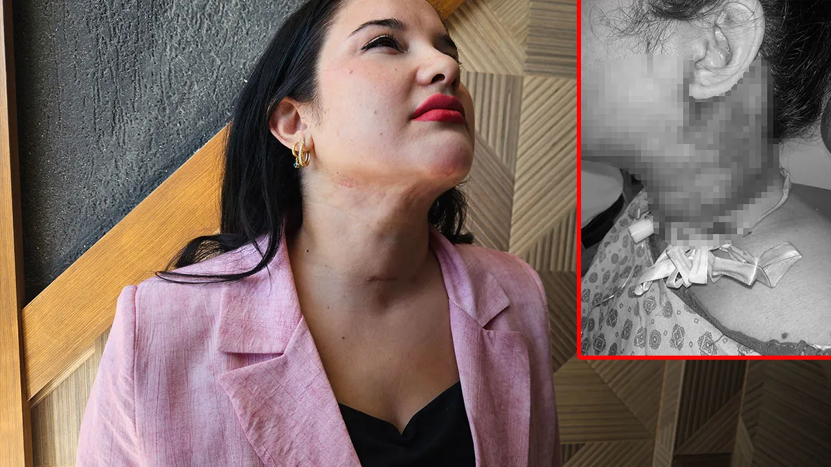 Ayrıntılar Netleşti: Antalya'da estetik isteği yoğun bakıma düşürdü: Doktordan böyle şikayetçi oldu! 'Hocam ne