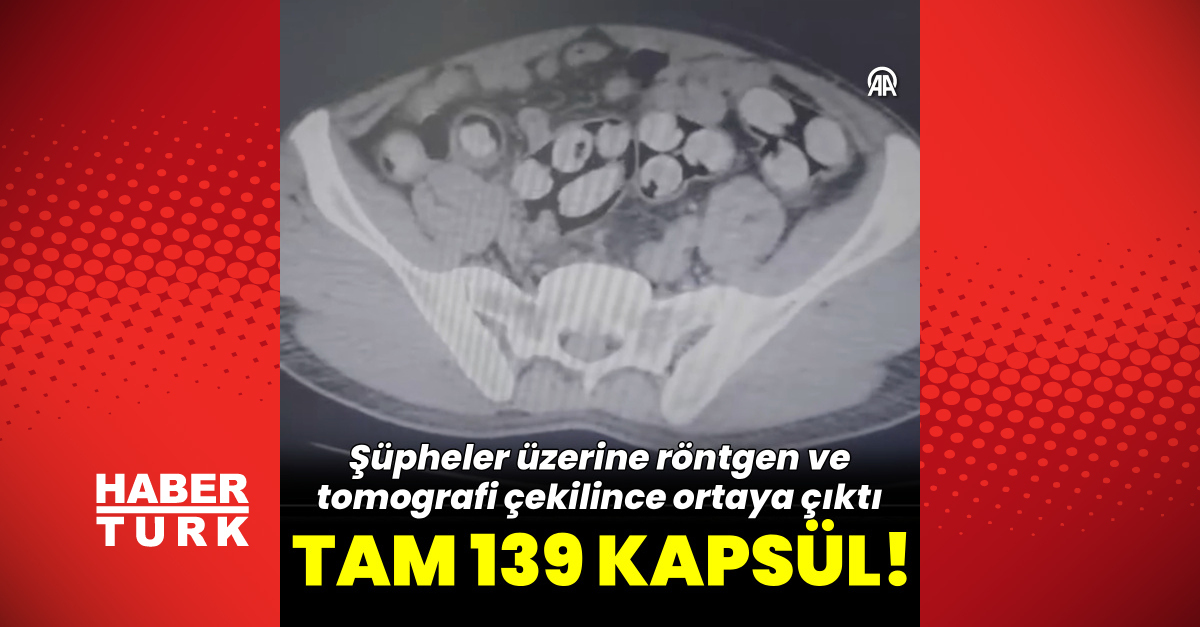 Kritik Açıklama: Tam 139 kapsül! Tomografide gözler önüne serildi - Son Dakika Bilgileri