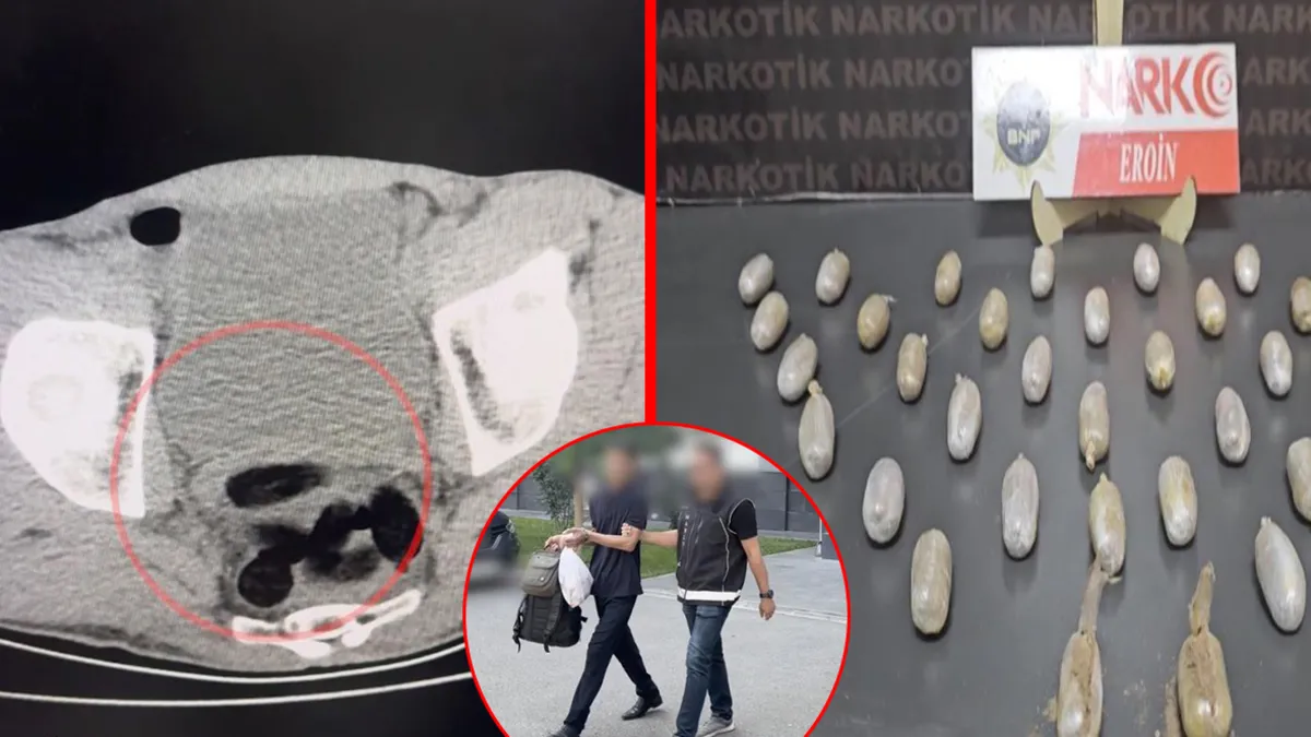Ayrıntılar Netleşti: Batman'da otobüsten indirildi: Midesinde 35 paket eroin tespit edildi: Gelişmeler Takip E