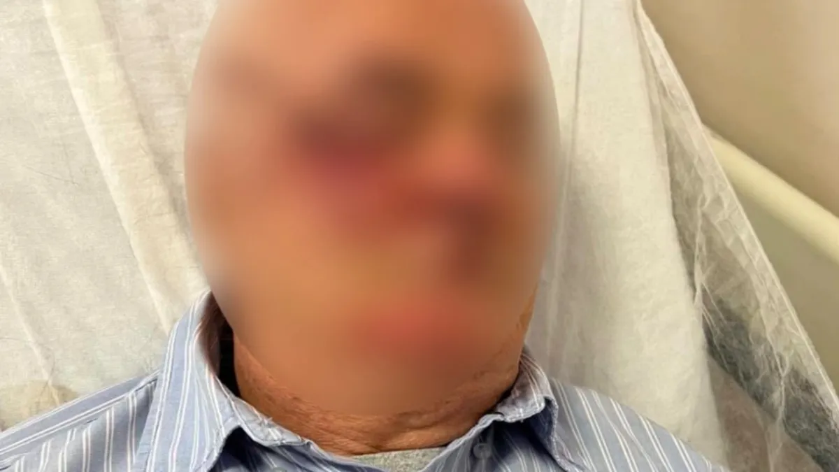 Ayrıntılar Netleşti: Çocuğunu uyaran emekli başkomisere teşekkür yerine ‘darp’: Gelişmeler Takip Ediliyor