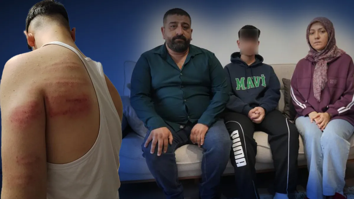 Kritik Açıklama: Niğde'de 15 yaşındaki berber çırağına demir sopalı darp iddiası: "Hem dövdü hem video çektird