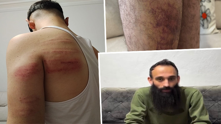Ayrıntılar Netleşti: Demir sopalarla dövüp tuvalete kilitledi: Çıraklara işkenceye yeniden gözaltı