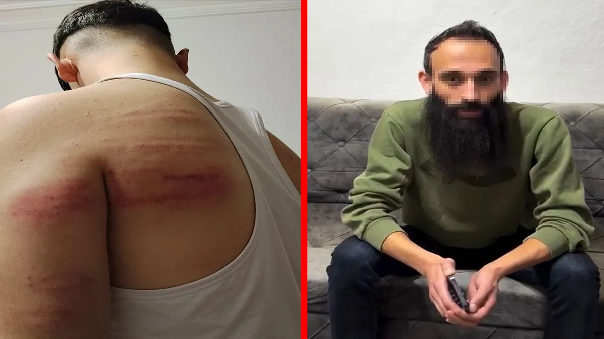 Ayrıntılar Netleşti: Niğde'de berber dehşeti! Çıraklarına işkence etti iddiası: Cani yeniden yakalanarak gözal