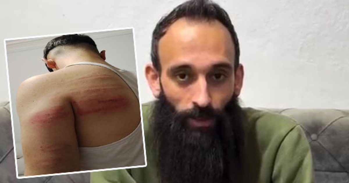 Gündemden Son Bilgiler: Berber şiddeti! 2 çırağını demir sopayla dövdü - Son Dakika Bilgileri