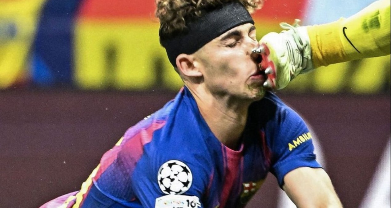 Sıcak Gündem: Atletico Madrid-Barcelona maçında yürekleri ağza getiren sakatlık - Son Dakika Haberleri