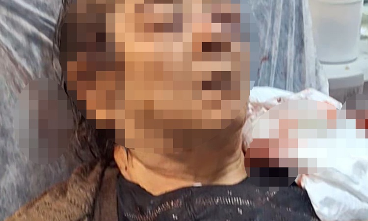 Ayrıntılar Netleşti: Kayseri'de tavandan düşen sıvayla 75 yaşındaki kadında sol gözde görme kaybı saptandı | İ