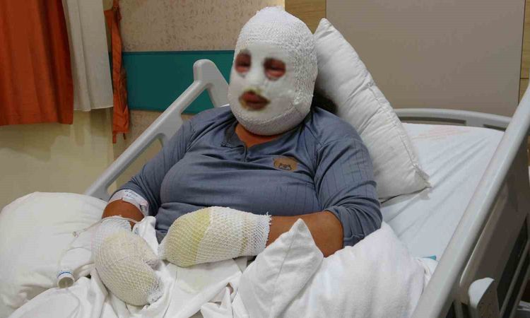 Ayrıntılar Netleşti: Kızını kurtarmak için alevlerin arasına girdi, kendisi de yandı