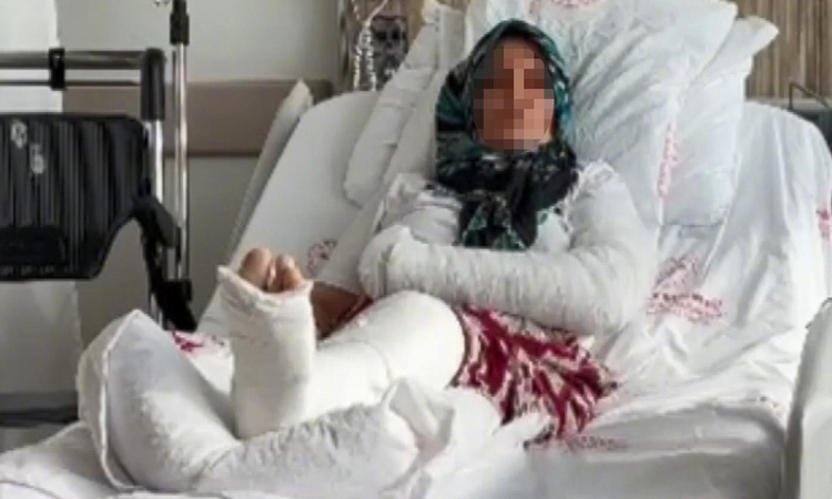 Ayrıntılar Netleşti: Mersin'de tatlıcıda saldırıya uğrayan 3 çocuk annesi kadının kolu ve bacağı kırıldı - Son