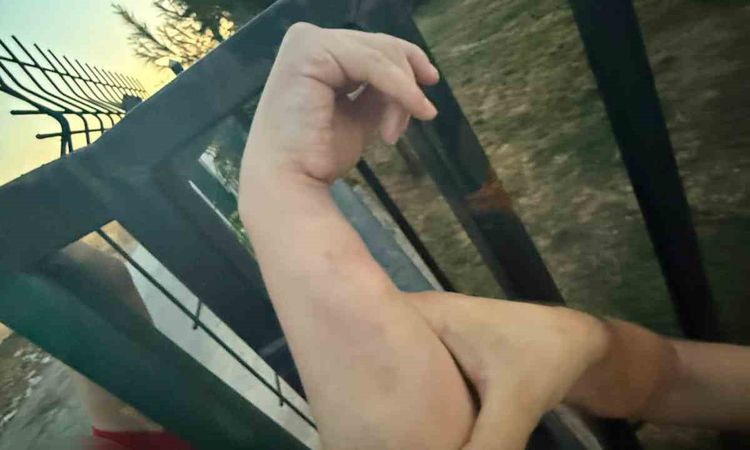 Son Gelişme: Batman'da Kolu Demir Korkuluklara Sıkışan Vatandaş Kurtarıldı - Son Dakika | İşte Tüm Ayrıntılar