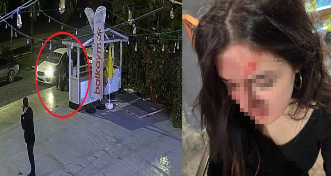 Prison sentence for those who beat Belinay in the middle of the street! - News