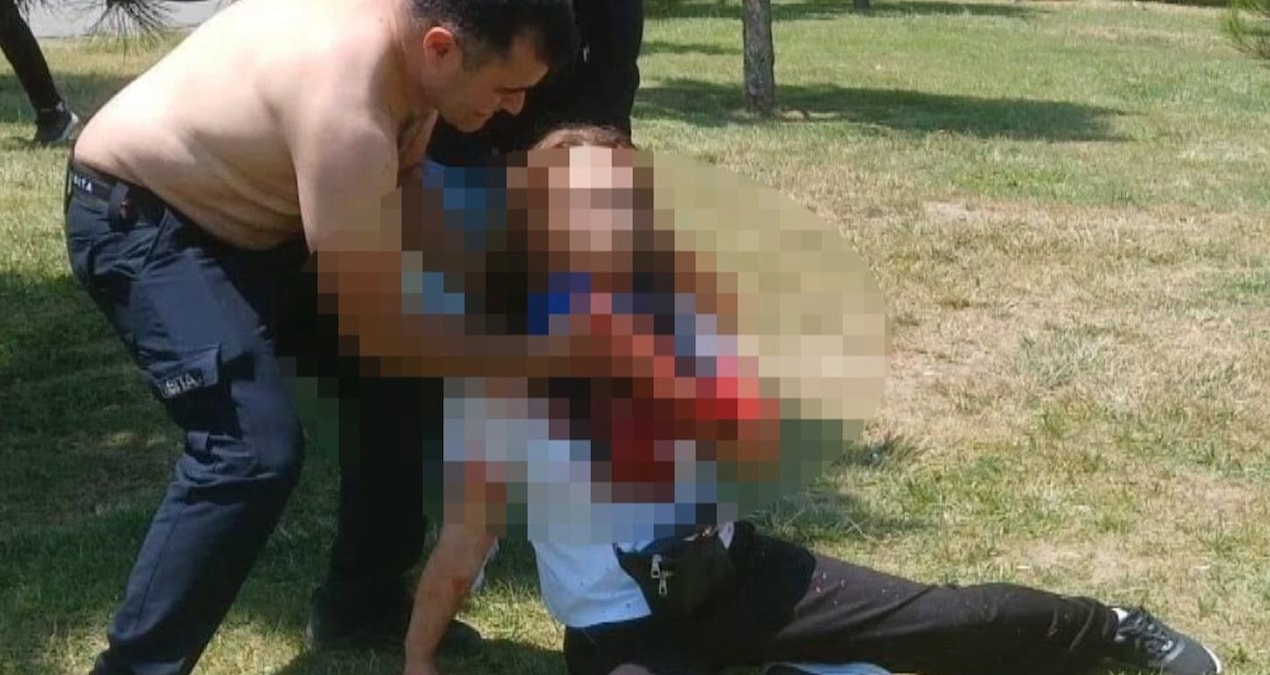 He stabbed his wife, who was going through a divorce, in the throat in the park - News