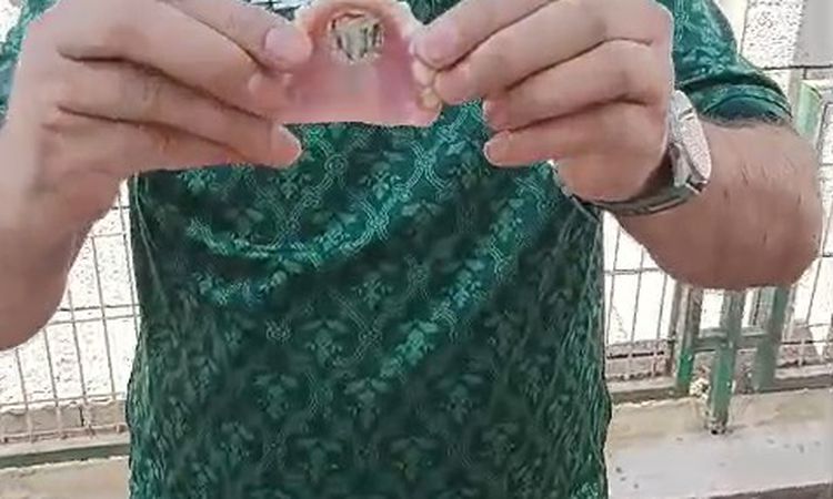 Son Gelişme: Bursaspor Tutkunu Dişine Amblem Yaptırdı - Son Dakika ve Merak Edilenler