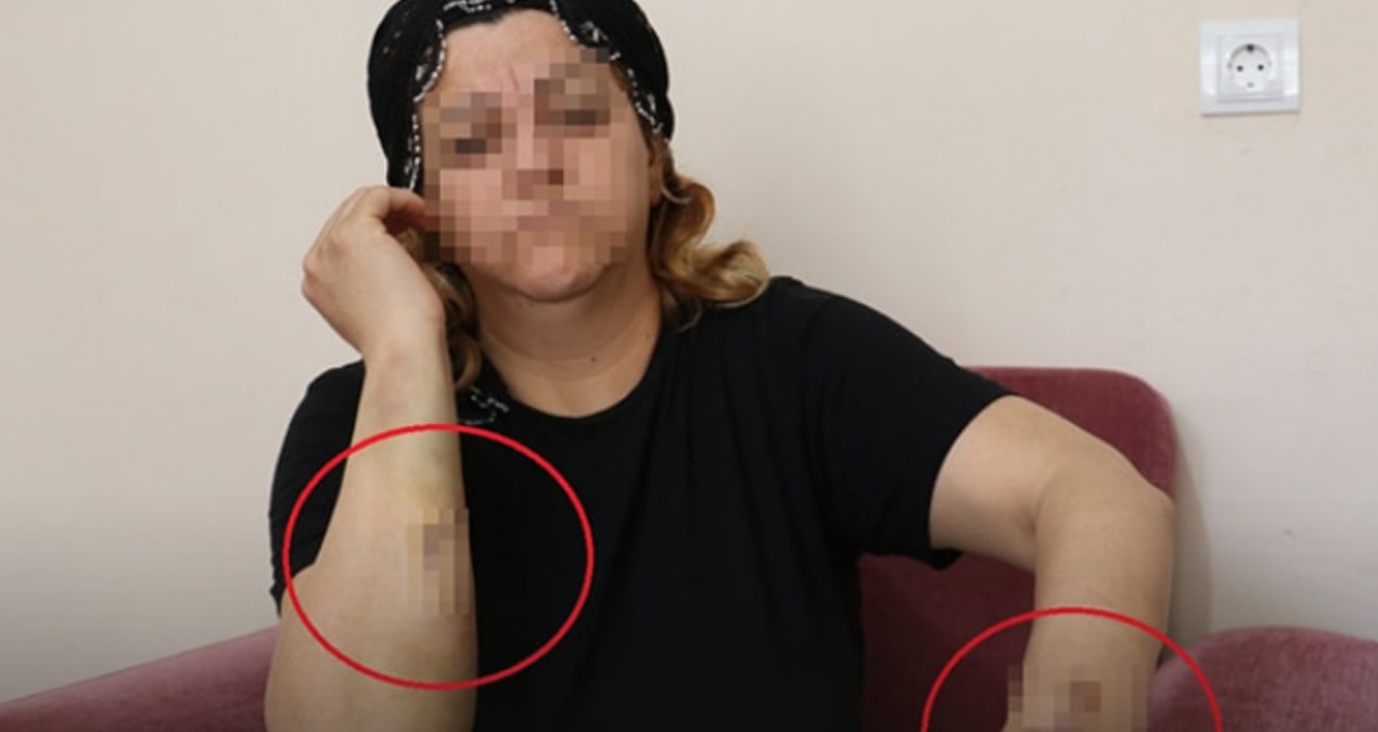Kritik Açıklama: Diyarbakır’da kanlı pusu! Talihsiz kadını 30 yerinden bıçakladı - Son Dakika Haberleri ve Mer