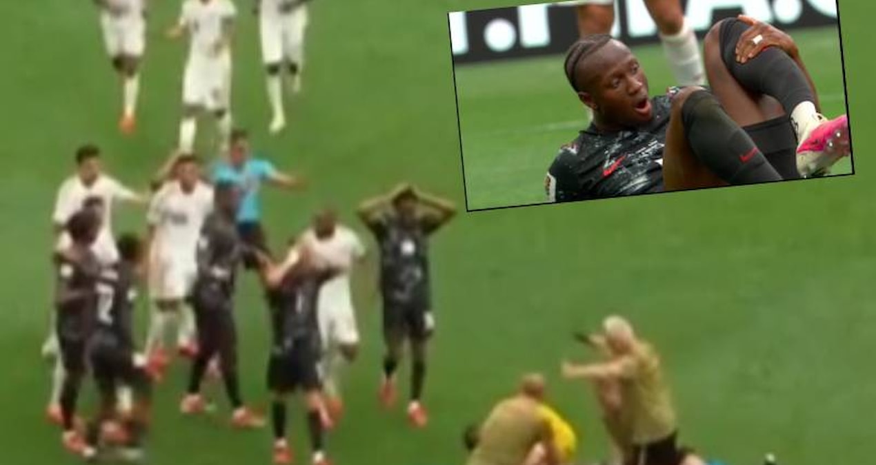 Ayrıntılar Netleşti: Dünya Kupası’nda büyük şok! Kanadalı futbolcunun ayağı kırıldı - En Son Haber | İşte Tüm