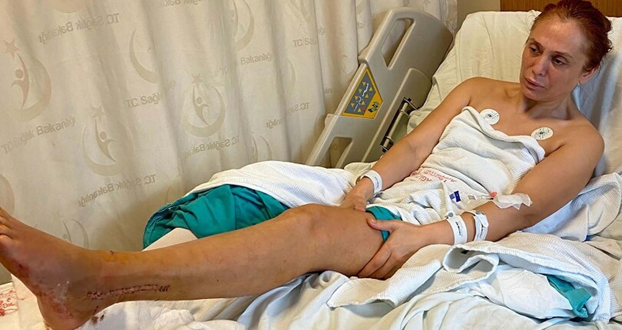 He hit his ex-wife and child with a car, was sentenced to 20 years in prison - Breaking News