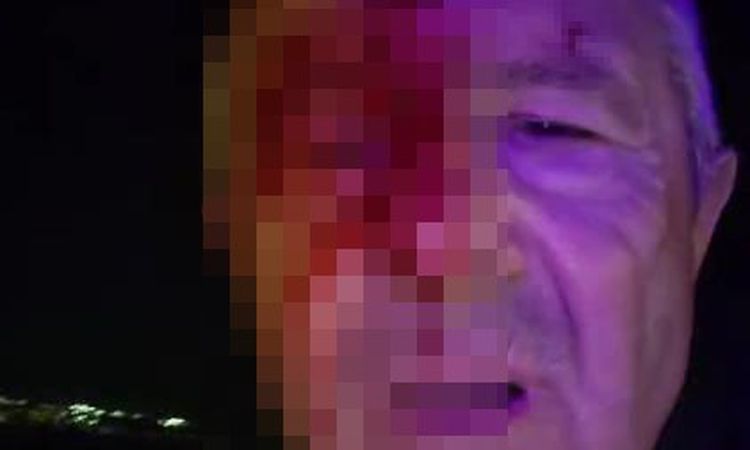 Son Gelişme: Haber yaparken taarruzya uğrayan muhabir yaralandı - Son Dakika - Son Dakika Bilgileri
