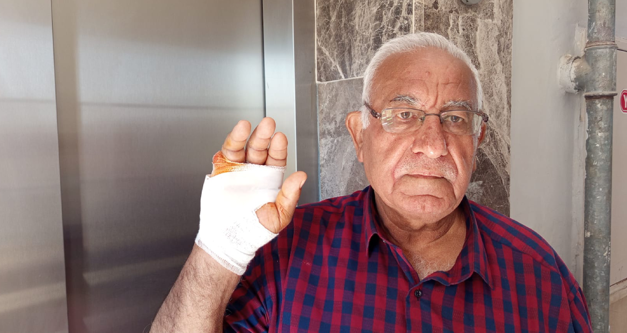 Ayrıntılar Netleşti: Hatay'da akılalmaz olay: Çok sevdiği komşusu parmağını ısırarak kopardı - Son Dakika: Gel