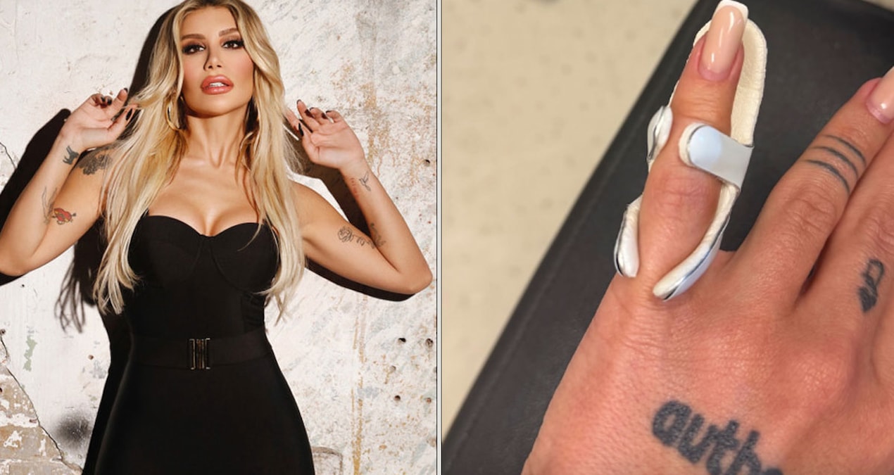 İrem Derici's finger was bent: The reason concerns millions of phone users - Last Minute News