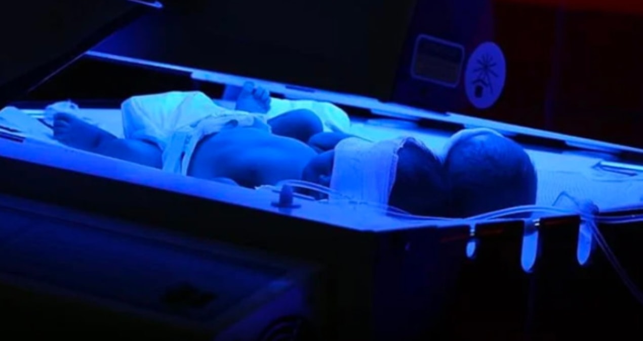 Son Gelişme: İstanbul'da kuvözde unutulan 17 günlük bebek yandı - En Son Haber - Son Dakika Bilgileri