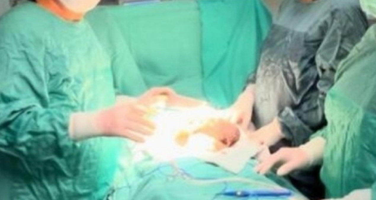 Ayrıntılar Netleşti: Karın ağrısıyla hastaneye götürdüler! Küçük çocuğun midesinden çıkan şey şoke etti - Son