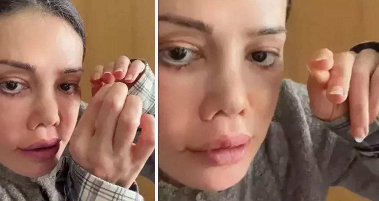 Ayrıntılar Netleşti: Kaşında saç çıktı! “Biri bana açıklasın” diyerek gündem oldu - Haberleri: Gelişmeler Taki