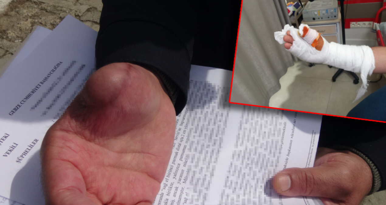 Ayrıntılar Netleşti: Bir kesikle hayatı karardı: 'Parmağım çürümeye resmen start aldı' - Haberleri - Son Dakik