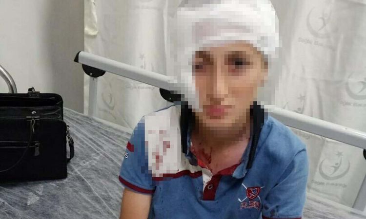 Köpek saldırısında yüzü kalıcı iz kalan çocuk için 1,2 milyon TL tazminat | İşte Tüm Ayrıntılar