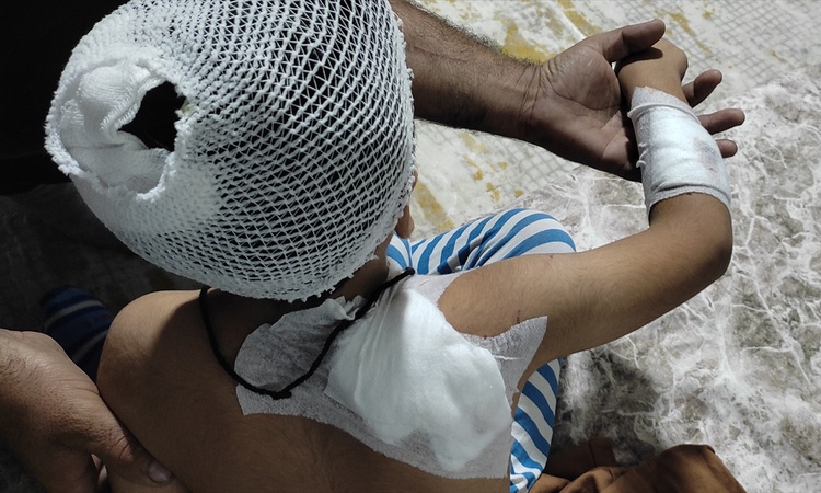 Kritik Açıklama: Şanlıurfa Viranşehir'de sahipsiz köpek saldırısından yaralanan çocuk taburcu edildi - Son Dak