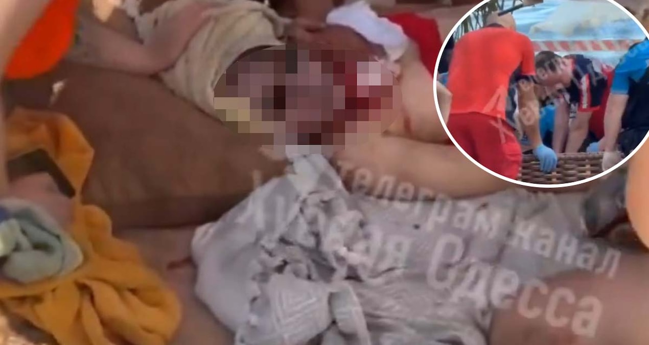 Gündemden Son Bilgiler: Odessa’da plajda güneşlenen kadın Rusya’nın dron saldırında öldü - Son Dakika ve Merak