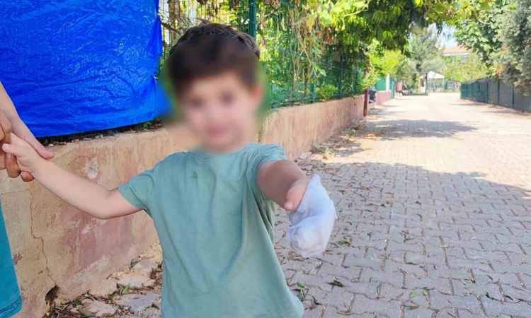 Polis Eskortuyla Hastaneye: 3 Yaşındaki Çocuğun Eli Kurtarıldı