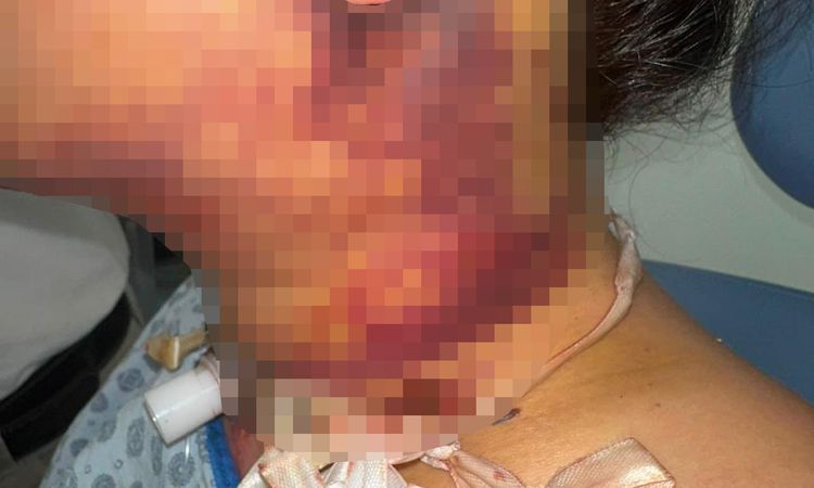 Sıcak Gündem: Estetik ameliyatı sonrası yoğun bakımda 2 gün tedavi gördü, doktor hakkında şikayetçi oldu - Son