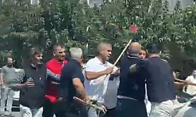 Son Gelişme: Sokakta taşlı sopalı kavga; 3 yaralı | İşte Tüm Ayrıntılar