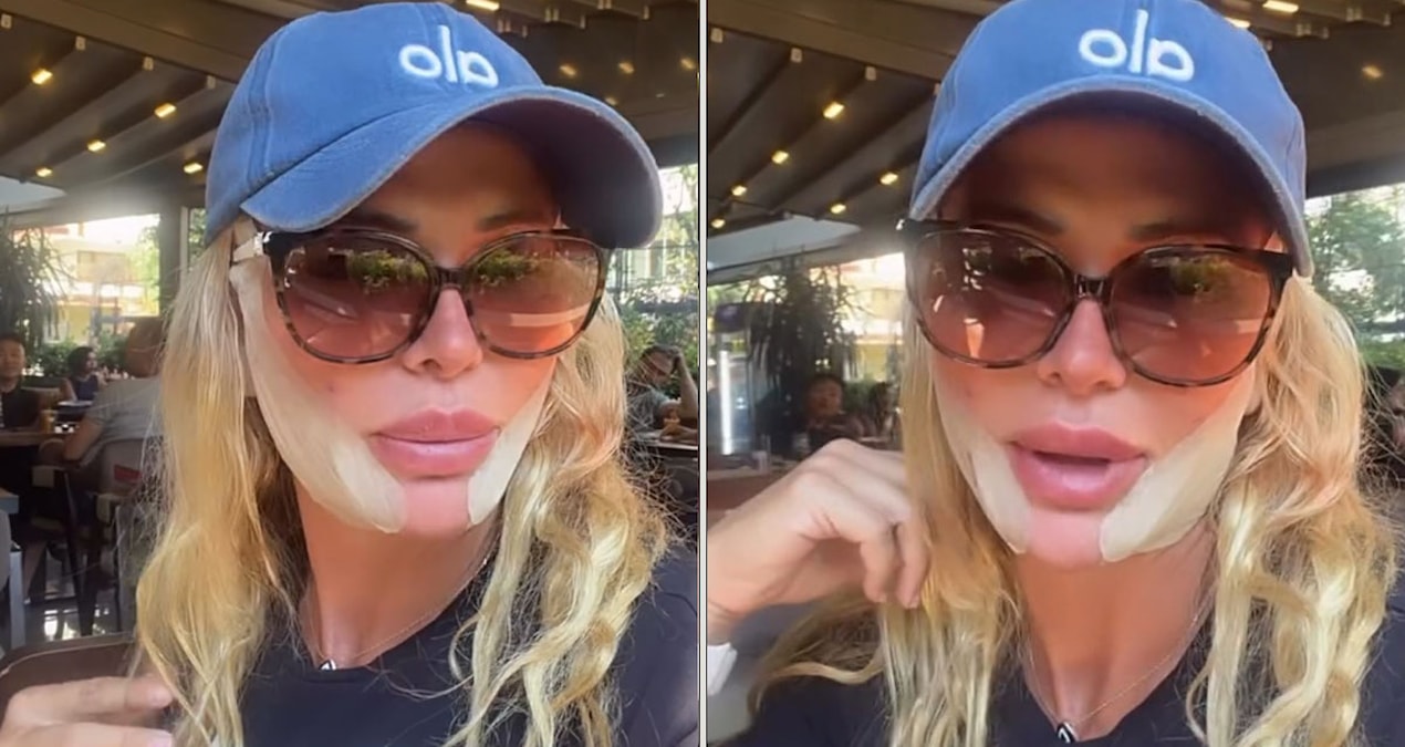 She had plastic surgery as soon as she returned from Survivor: People who saw her on the street could not recognize her - Breaking News