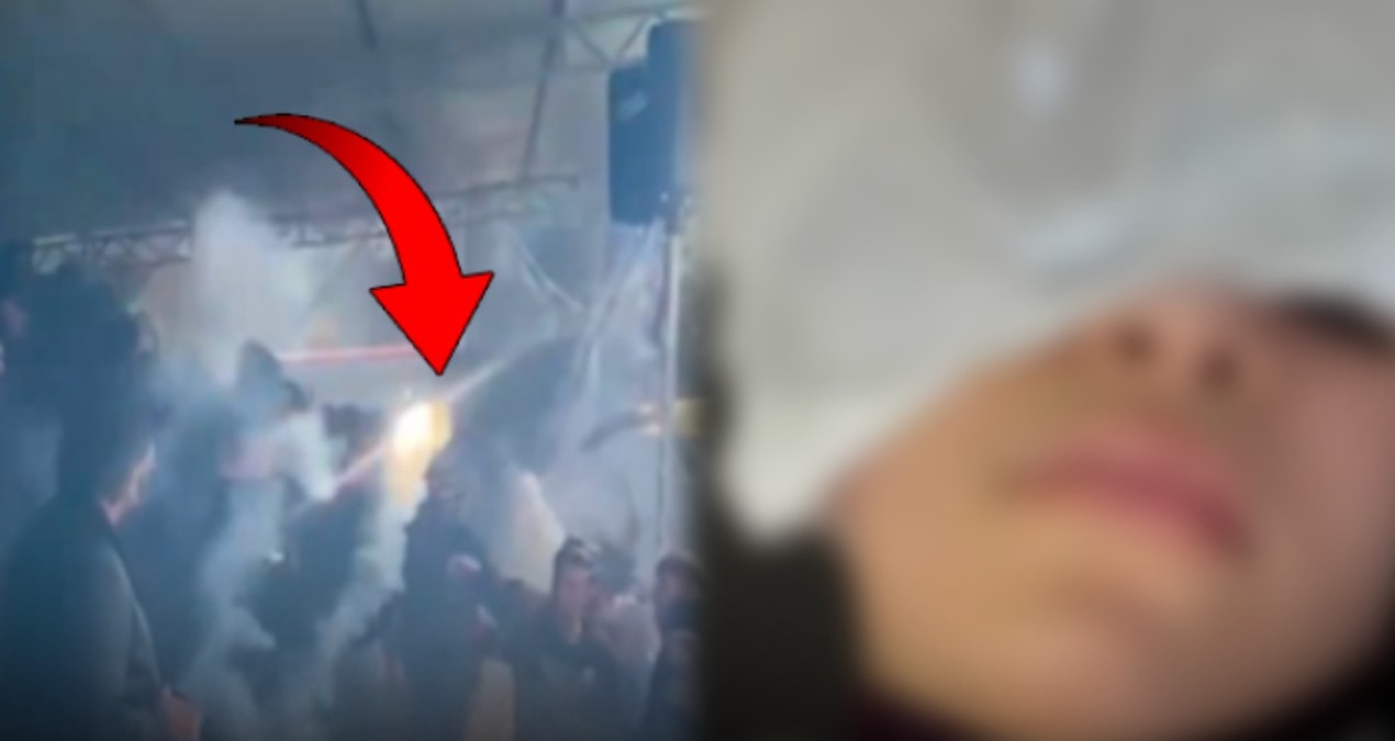Tribünde maganda dehşeti: Meşale kız çocuğunun gözüne girdi! - Son Dakika Haberleri