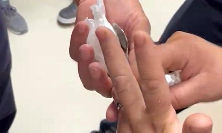Fire brigade rushed to the aid of the woman whose ring got stuck on her finger - Last Minute